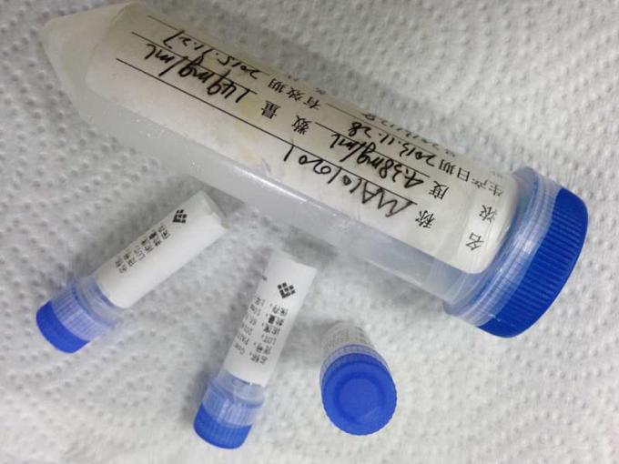 반대로 쥐 - 효소 Mab 하이브리도마 단일 클론항체를 개조하는 앤지오텐신