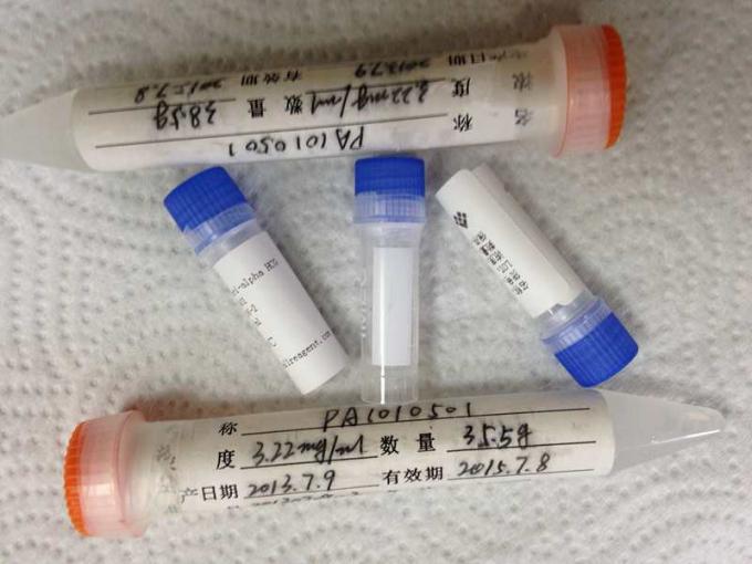 IgG HRP 감염증 재조합형 항원 고성능