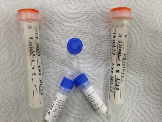 쥐 IVD 제조를 위한 반대로 HBcAg Mab Monoclone 항체 약물 남용