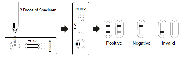 옆 교류 Immunochromatographic는 AllTest iGFBP-1 질 출력에 있는 급속한 시험 카세트를 분석합니다