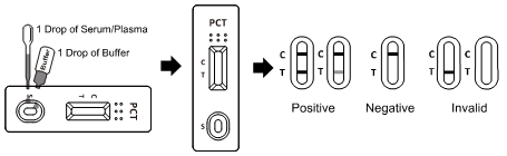 Procalcitonin 품질 탐지를 위한 급속한 세균성 시험 장비