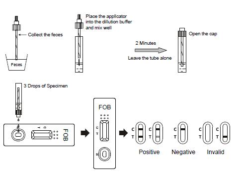 세륨을 가진 Cryptosporidium 그리고 Giardia Lamblia 결합 급속한 진단 테스트