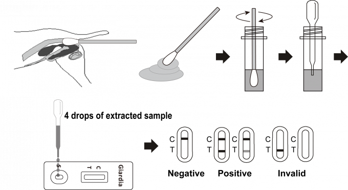 정확한 Giardia 항원 카세트 샌드위치 체재에 근거를 두는 급속한 시험 장비