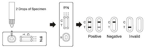 태아 Fibronectin 급속한 시험 카세트, 25t 급속한 응답 약물 테스트 장비