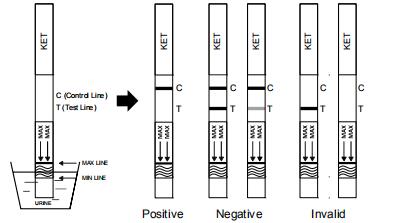 세륨을 가진 인간적인 소변에 있는 Ketamine 약물 남용 하나 StepTesting 고품질 정확한 진단 장비