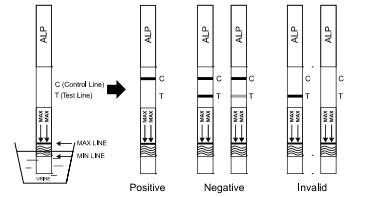 100개 Ng/ML 정확한 Alprazolam 단 하나 약 급속한 소변 검사 의학 제품