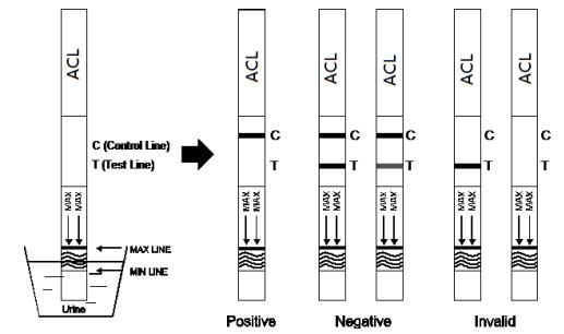 300ng/mL 7-Aminoclonazepam (7-ACL) Dispoable 세륨을 가진 급속한 약물 남용 장비 카세트/계량봉/지구 시험 장비 OEM