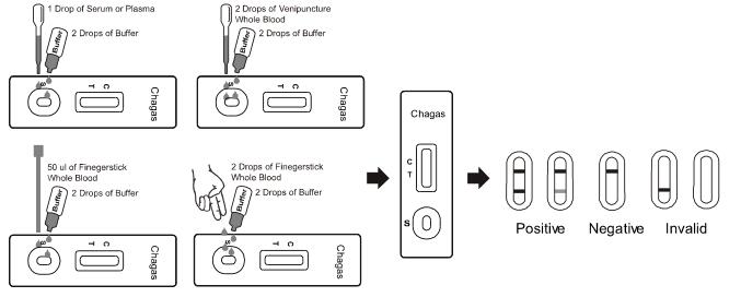 Chagas 급속한 시험 카세트 (전혈/혈청/플라스마)