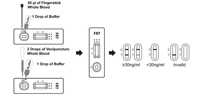 페리틴 Immunochromatographic 분석실험 시험, 높은 Quilified를 가진 급속한 면역 분석법
