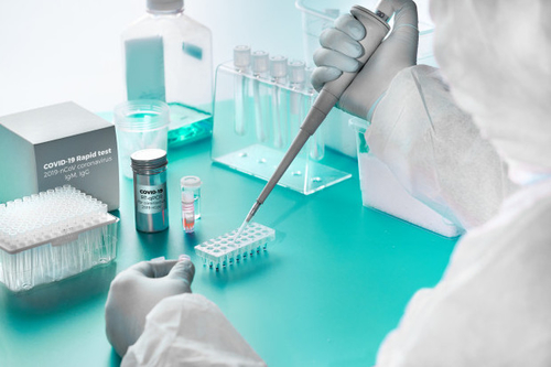 에 대한 최신 회사 뉴스 The Effect of Immunoglobulins (IgA, IgG, IgM)
